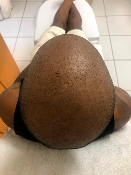 antes-tratamento-capilar-x antes-tratamento-capilar-x