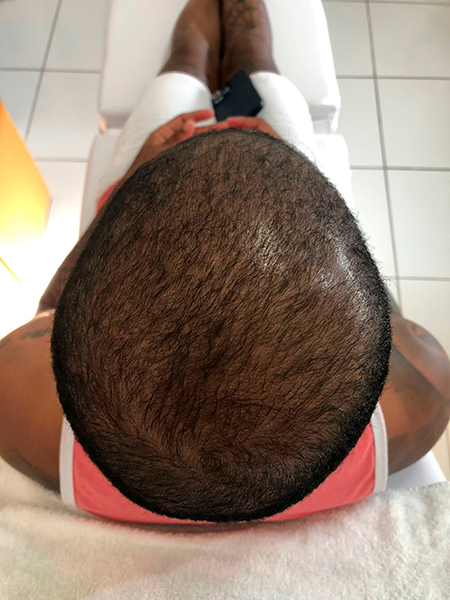 depois-tratamento-capilar-x