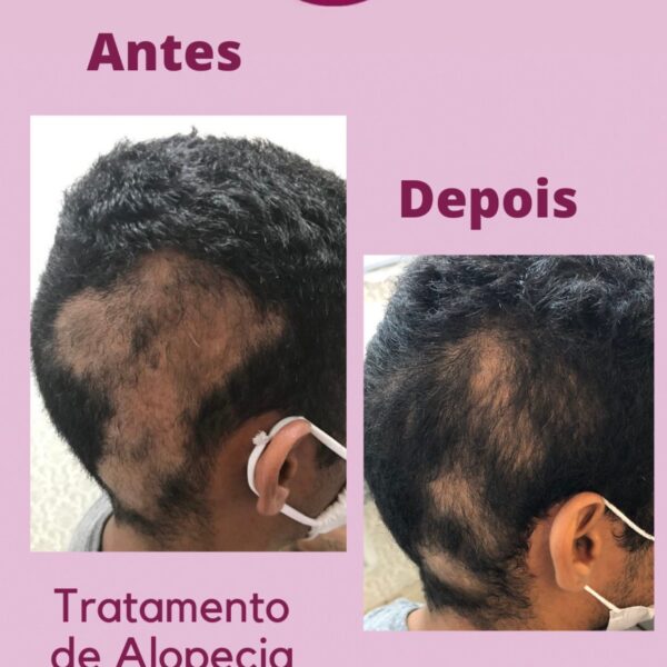 svterapiacapilar__2021-06-01T180611.000Z