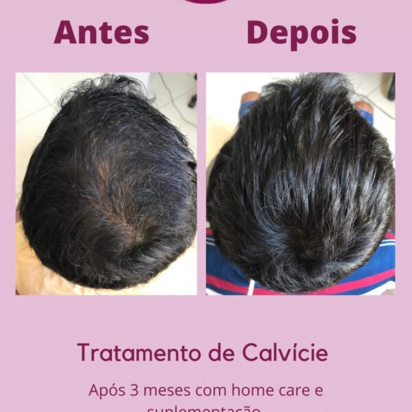 svterapiacapilar__2021-06-01T180625.000Z